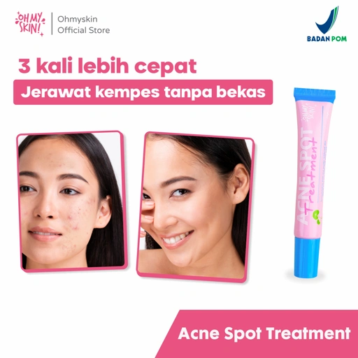Image of OH MY SKIN ! ACNE SPOT GEL TREATMENT / totol jerawat